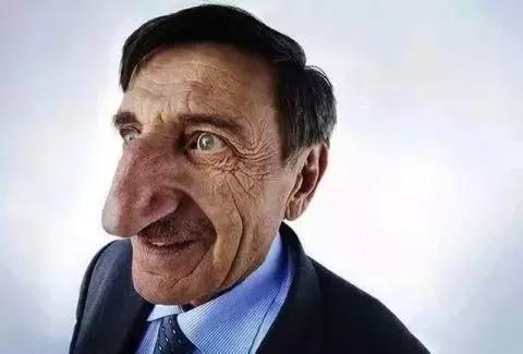3鼻子最大的人:这名土耳其男人具有世界上最大的鼻子.
