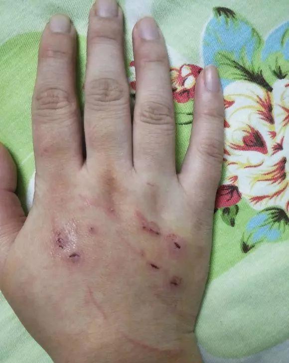 被猫咬了以后,主人生气痛揍猫咪5分钟,但现在后悔死了!