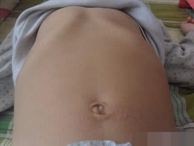 四岁女孩性早熟罪魁祸首原来是常喝这种东西你家的也可能中招