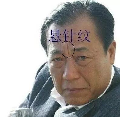 山根横纹(一条则一次大灾,二条二次,三条三次).