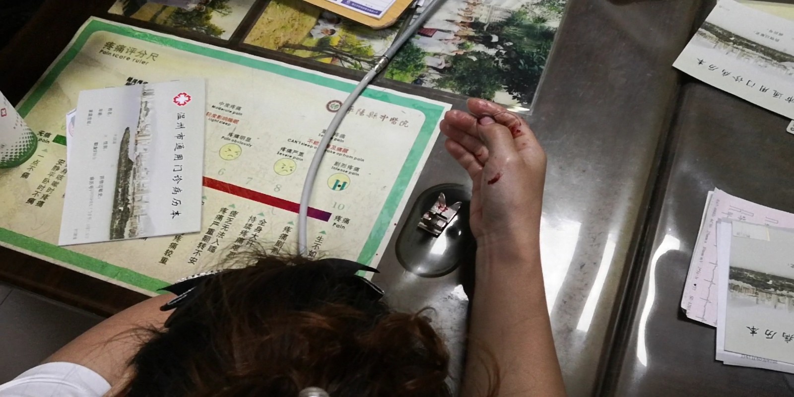 温州平阳缝纫机针头扎入大拇指消防官兵快速营救