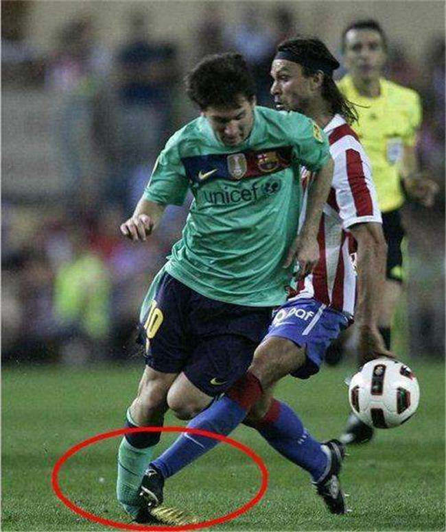 梅西的身体天赋有多强?骨折15天复出不说,脚踝还能外翻90度传球