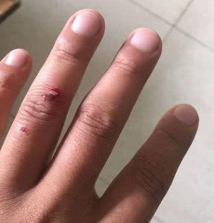 小伙本想摸摸狗狗的头和脸,在接近嘴巴的时候就突然被狗狗咬了一下