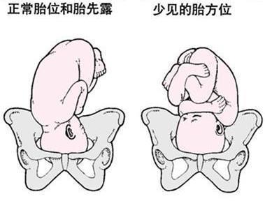 孕妈睡觉有讲究 不然等到胎位不正就晚了|胎位|胎儿|子宫_新浪新闻