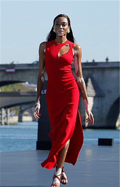 白癜风模特温妮,哈洛一身红裙秀好身材