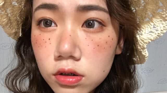 祛斑得分类型有些真祛不掉网友雀斑女人更可爱时髦