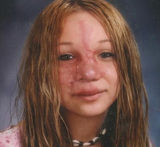 美国女子其丑无比,老公却始终爱她如初,手术后的她让人心疼