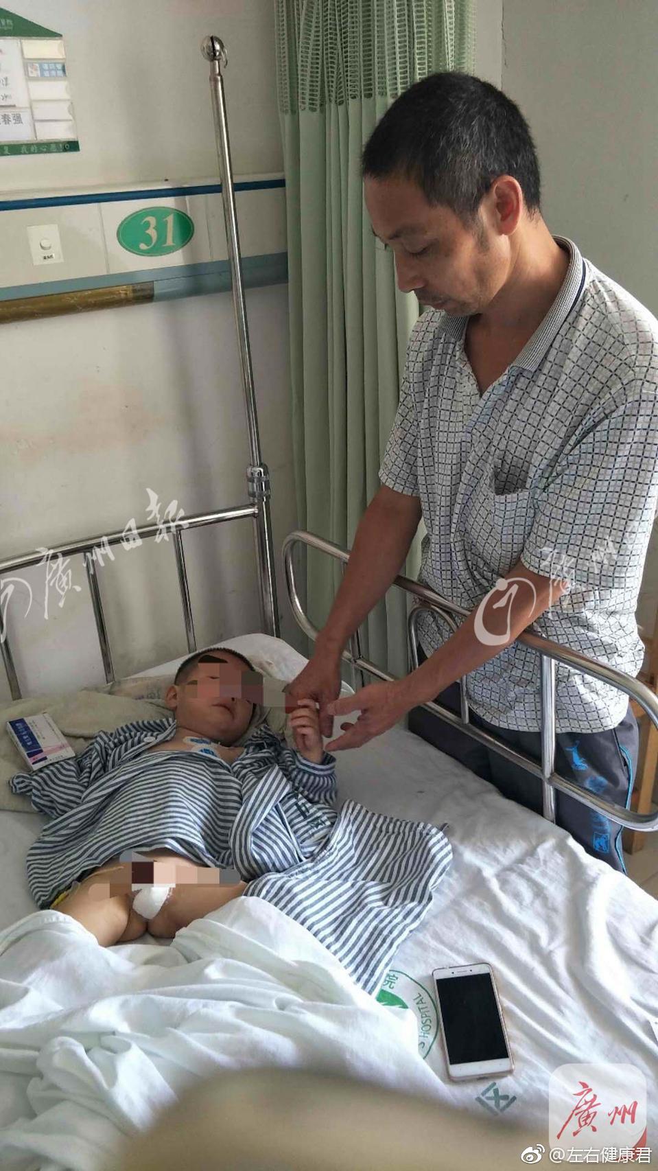 母亲精神病发作割断2岁儿子命根