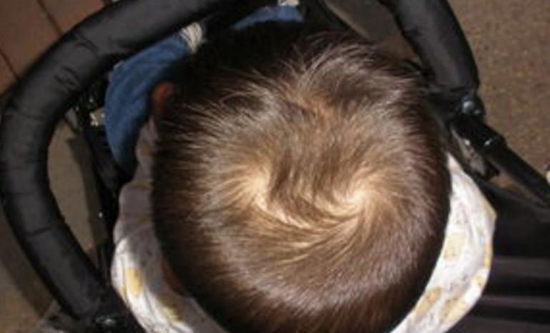 这些特殊的发旋,由于位置比较特殊,只会对做发型有一定的影响.