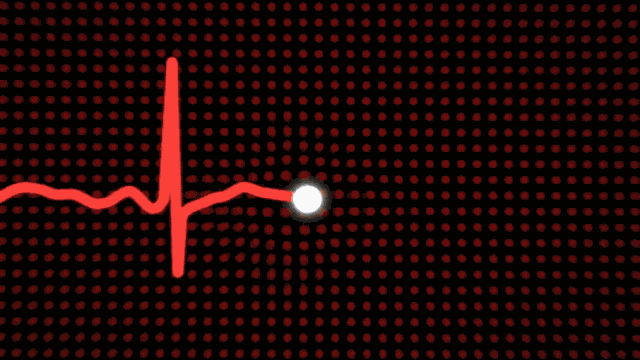 想看看大家的心脏能不能承受得住,新苹果表还加入了心电图功能,分分钟