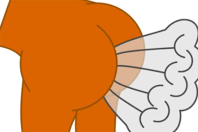 宝宝总是放臭屁,宝妈要留心了,尤其是这3种屁关乎宝宝健康