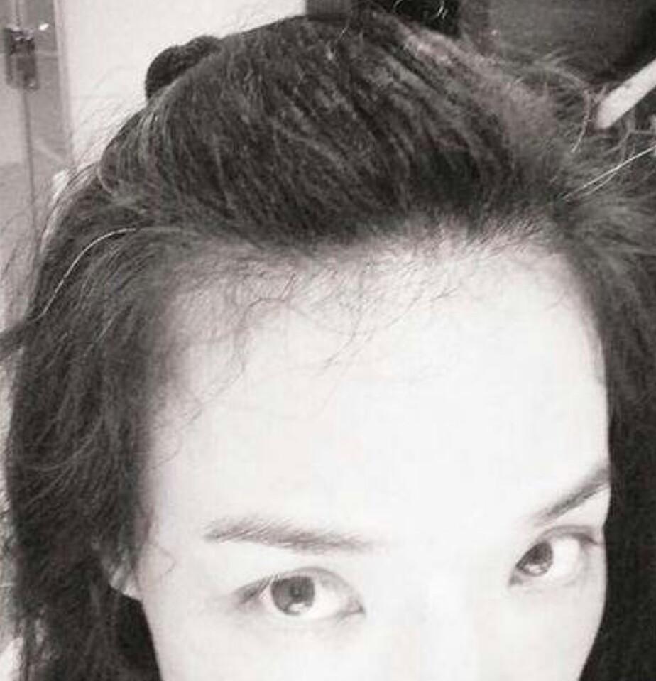 盘点年纪轻轻就长白头发的八大明星,看看谁最让人心疼!