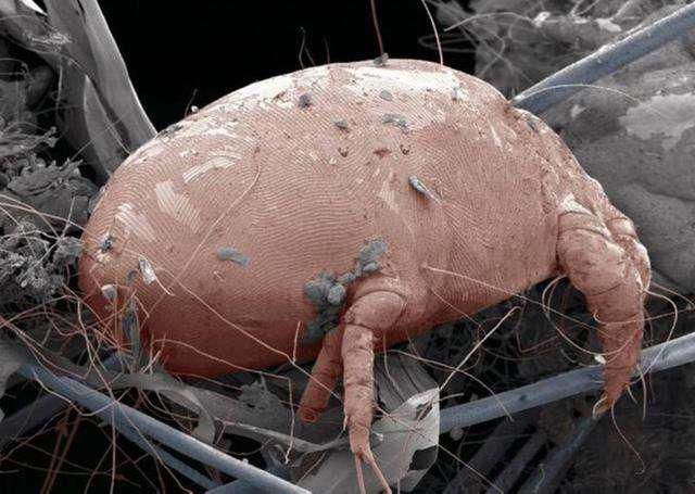 床上螨虫超级多?教你1小招,不到一毛钱,螨虫全部不见!