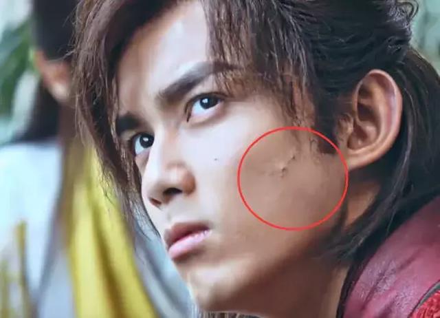 斗破苍穹:美颜都不开,吴磊的痘痘,米腾山的痘印,让人不敢直视