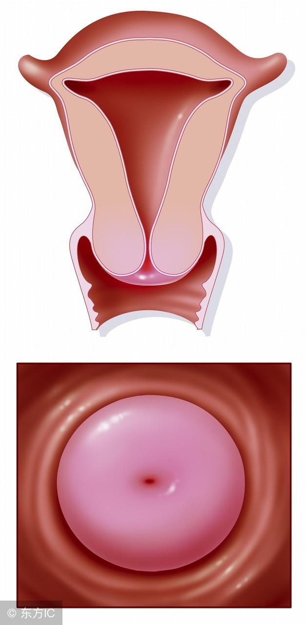 预防宫颈炎就要做好这四个事项