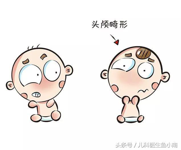 如果宝宝实在头颅畸形又大于4个月了,就要去医院使用专业手段矫正.