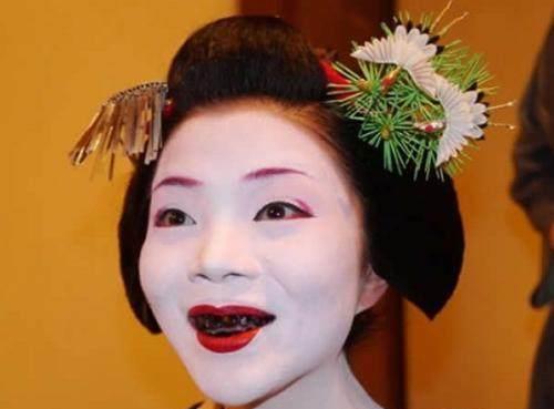 为什么大部分日本人的牙齿都不整齐?看完长见识了