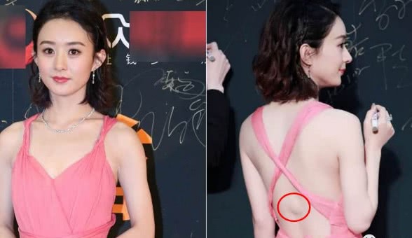 赵丽颖的腰伤好了很多,郑爽的腰伤慢慢好转,希望她们爱惜自己