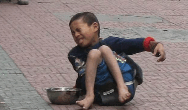 残疾儿童乞讨被拐卖图片