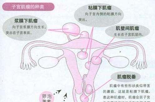 年轻女孩怀孕9个月, 产检医生建议剖腹, 肚子剖开医生却大汗淋漓