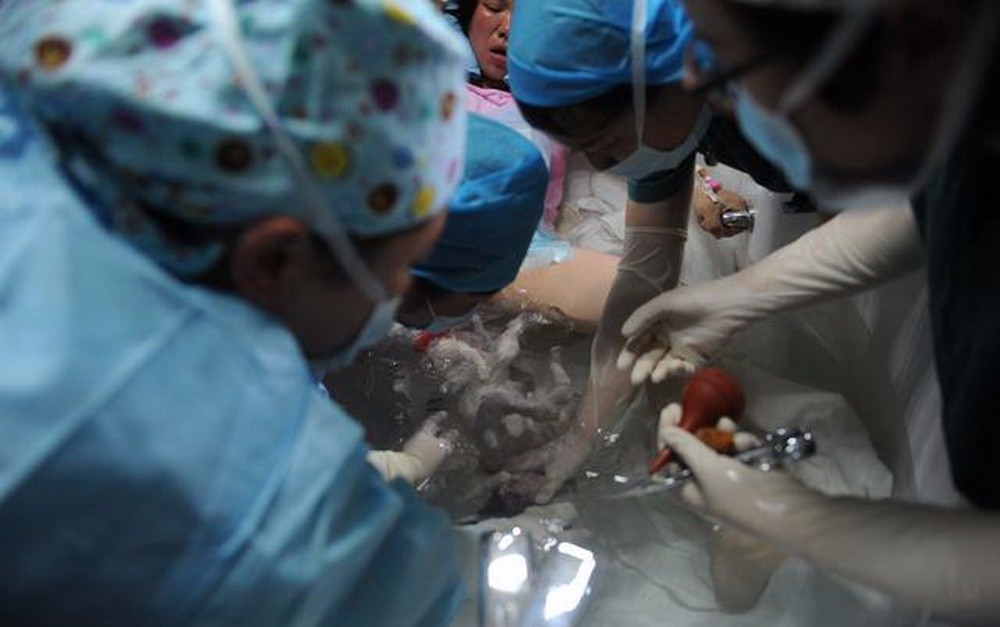 分娩,是人类繁衍过程中的一个必经过程,生育方式多元化,让人类分娩