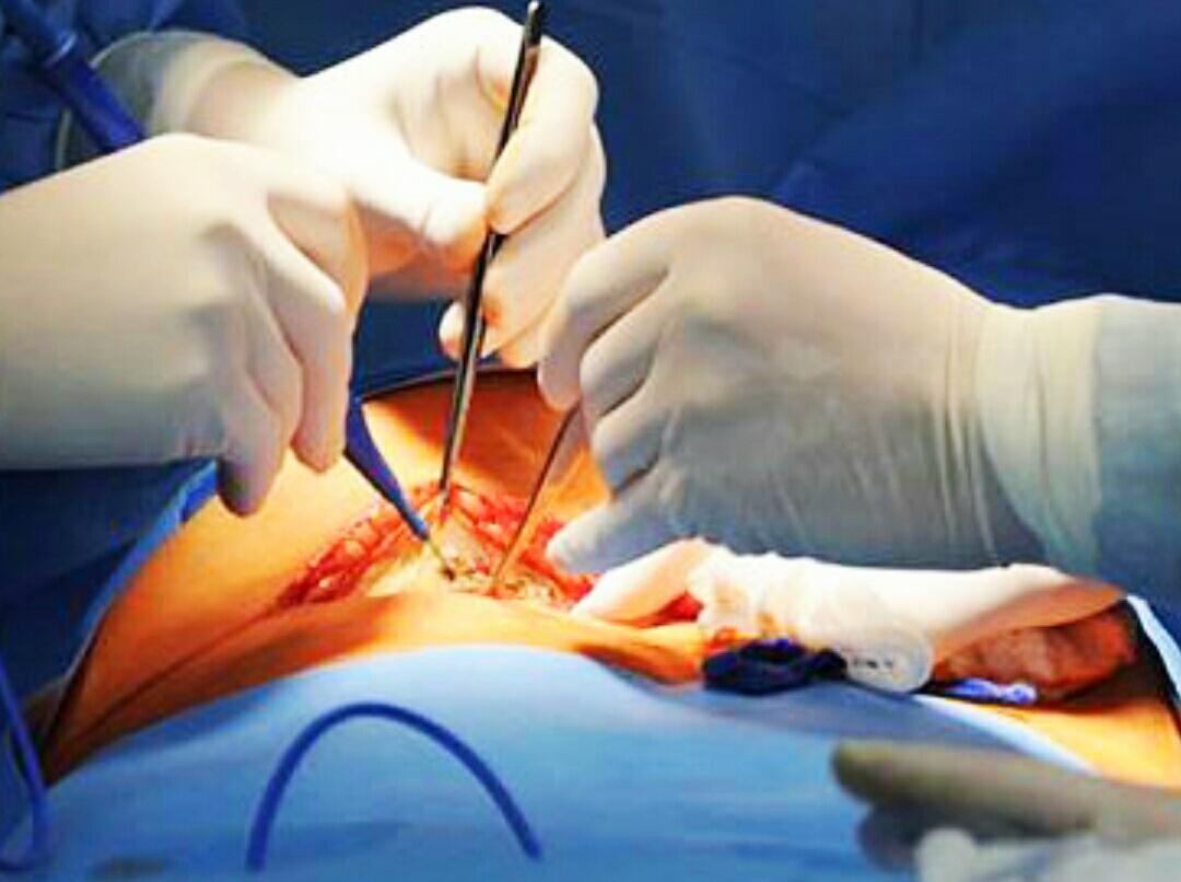 女子肚子疼痛难忍到医院手术后取出的东西令她崩溃了