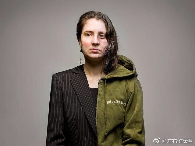 今天是国际禁毒日,一组照片告诉你,吸毒到底有什么危害!|吸毒|国际禁毒日_新浪新闻