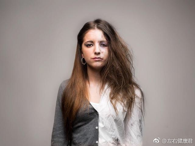 今天是国际禁毒日,一组照片告诉你,吸毒到底有什么危害!|吸毒|国际禁毒日_新浪新闻