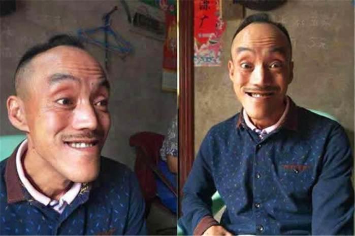 此人长得丑被妻子嫌弃,后因光头强而出名,今娶小20岁娇妻住别墅