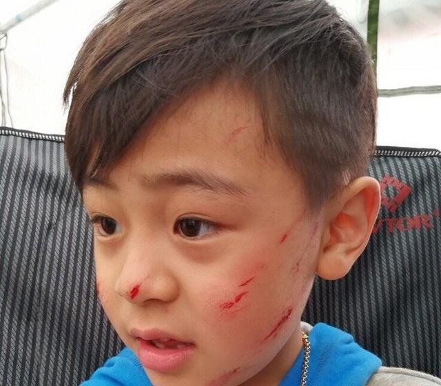 蔡国庆和庆庆, 地震"演习"中意外受伤, 心疼宝宝!