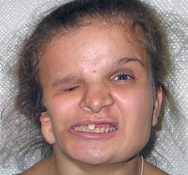 长大后的畸形女孩找到把自己遗弃的父母,却因为这个要求不幸离开