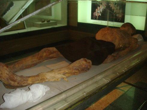 高昌国名将张雄的陵墓被发掘出来,专家说:他是因这个小毛病死的