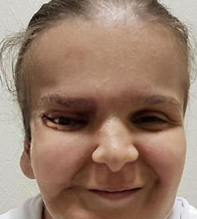 长大后的畸形女孩找到把自己遗弃的父母却因为这个要求不幸离开