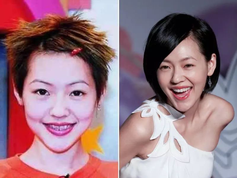 "|小s的牙套日记|牙套|牙齿_新浪新闻