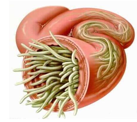 宝宝肚子里有没有蛔虫从这5点就能看出来家长别大意