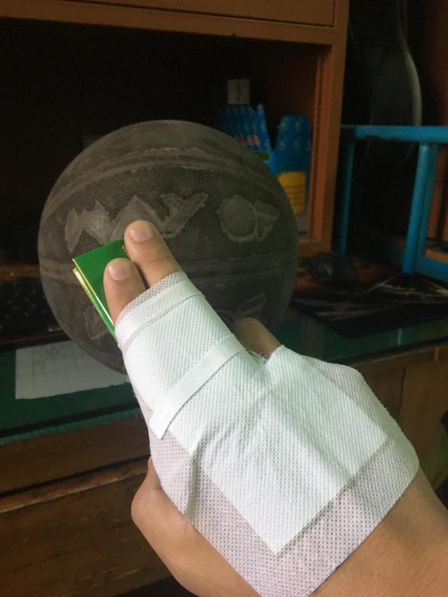 球,在第一次打球的时候就戳到了手指, 看着自己肿胀而略微疼痛的中指