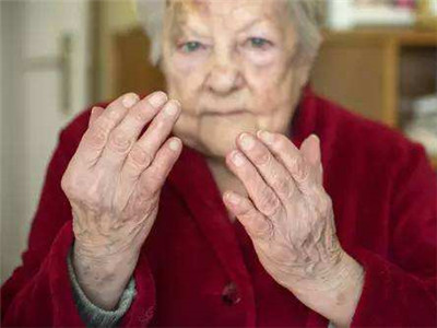 风湿是什么原因引起的?