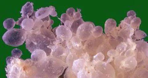 葡萄胎|恶性葡萄胎|绒毛_新浪网