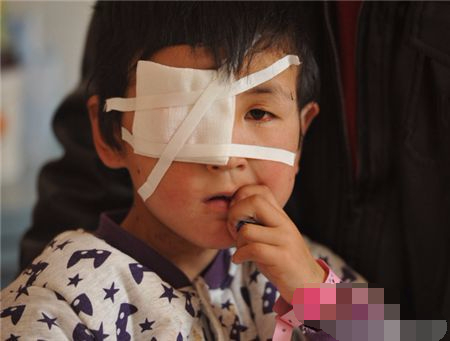 7岁男孩眼睛被抠瞎摘除,行凶者疑心智不全