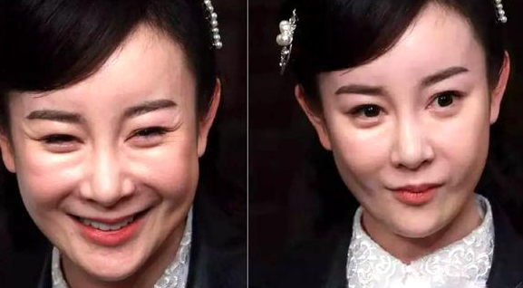 她本可以靠演技走红,却走歪路去整容,如今成《三千金》里最惨的