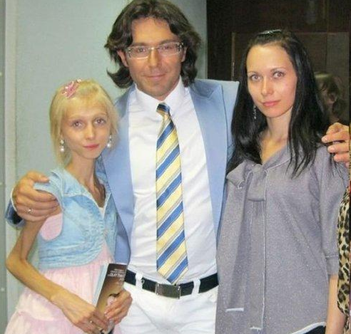 俄罗斯一女子为了拥有好身材,每天不吃饭只喝水,如今变成皮包骨