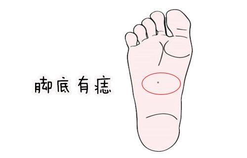 身上這幾處有痣,福氣多的,財運旺,一生富貴,你有嗎?!
