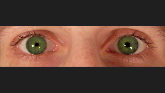 反应减弱2,对视觉刺激的反应减弱1,瞳孔无反射预示着癌症患者即将死亡