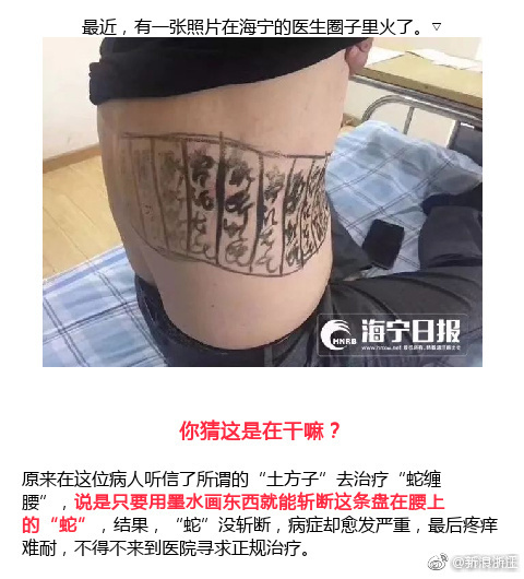 吓人 男子露出文身后 成功引起了医生的注意 吓人 男子露出文身后 成功引起了医生的注意