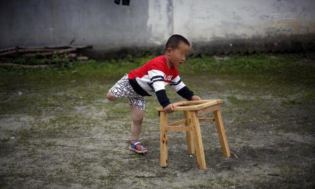 为了妈妈不再为自己流眼泪,5岁独腿男孩学会了奔跑要做个男子汉