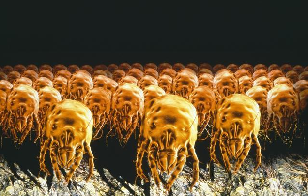 晨起头皮就油腻,暗示整晚上亿螨虫陪你睡,3个诀窍效铲除螨