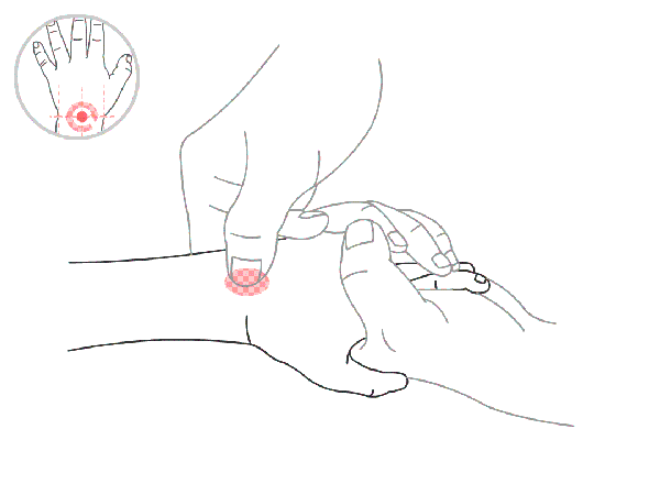 孩子感冒流清鼻涕小儿推拿来帮忙!