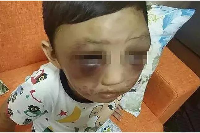 娃遭亲妈毒打却说后悔没掐死他,你的灵魂真心丑陋!