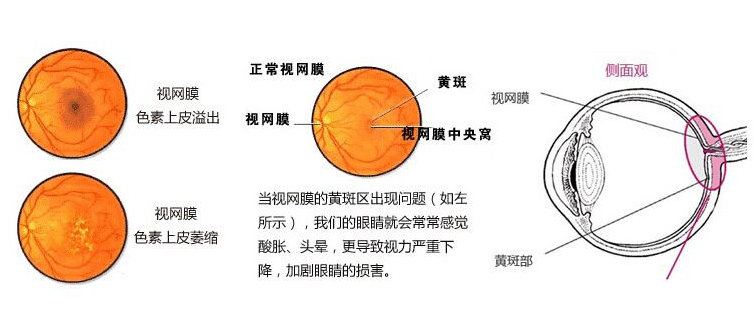 5个月宝宝突发视网膜病变,家长无知,医院检查,男子怒打妻子!