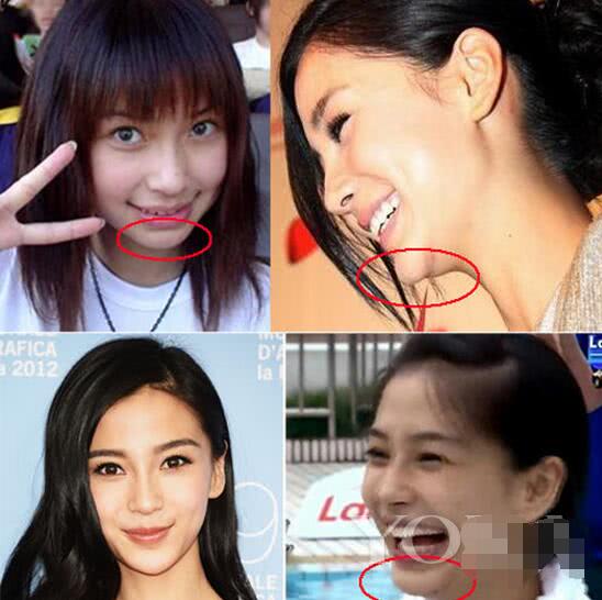 假体|杨颖|下巴_新浪新闻